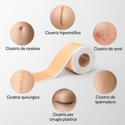 Cinta de Silicona Médica para Cicatrices